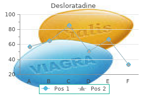 discount 5 mg desloratadine mastercard