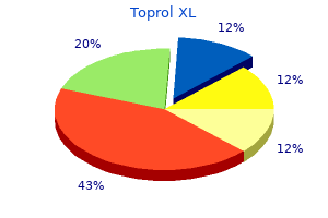 buy 100mg toprol xl amex